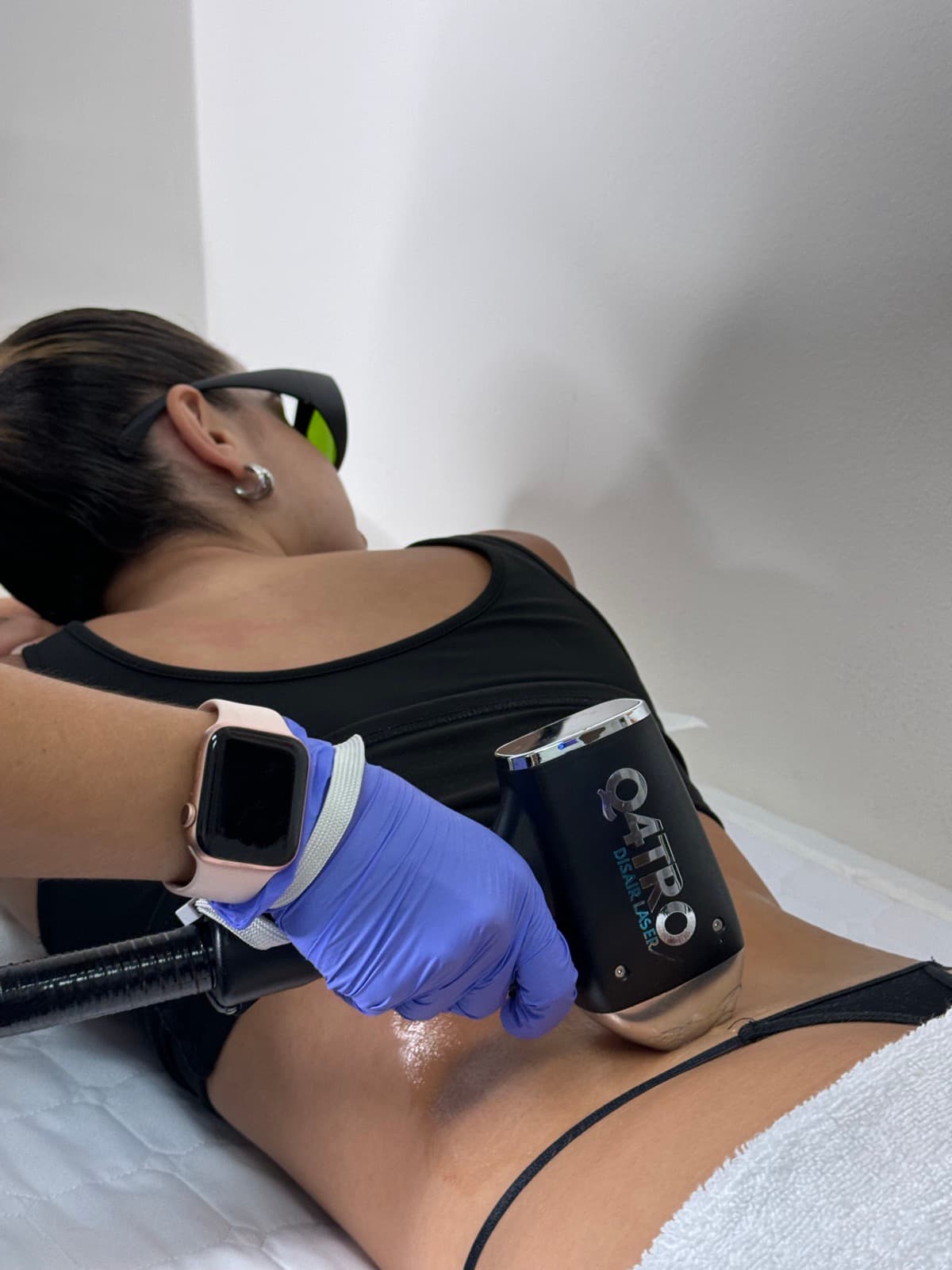 Sesión de depilación láser de espalda baja con manípulo Q4TRO, paciente de espaldas con gafas de protección — Bodyfree Panamá