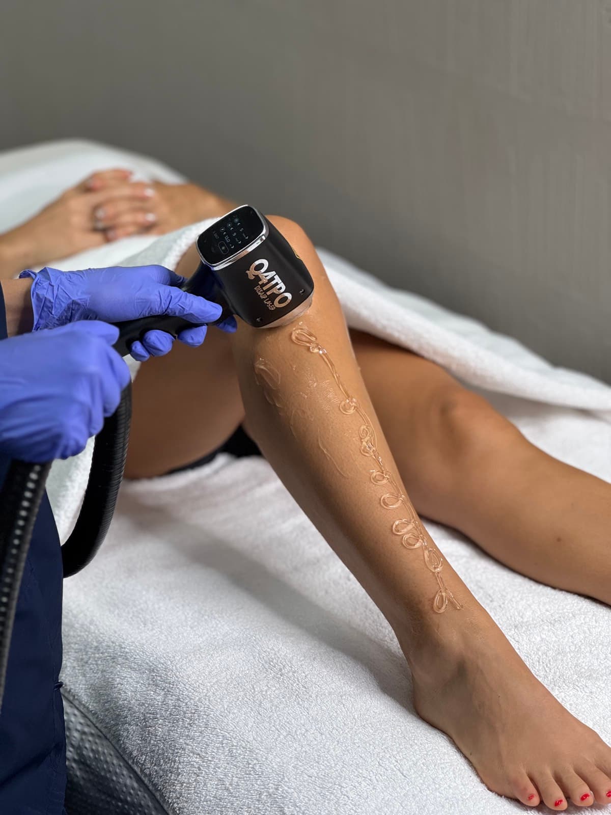 Técnica aplicando el láser Q4TRO sobre la pantorrilla con gel conductor en la cabina de Bodyfree Marbella, Panamá