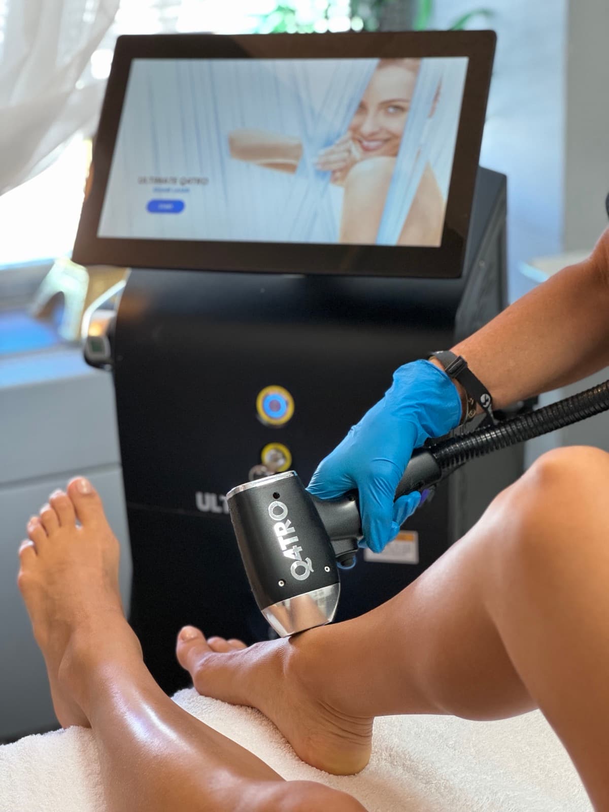 Calf laser hair removal session with the Ultimate Q4TRO system in the background — Bodyfree Panama