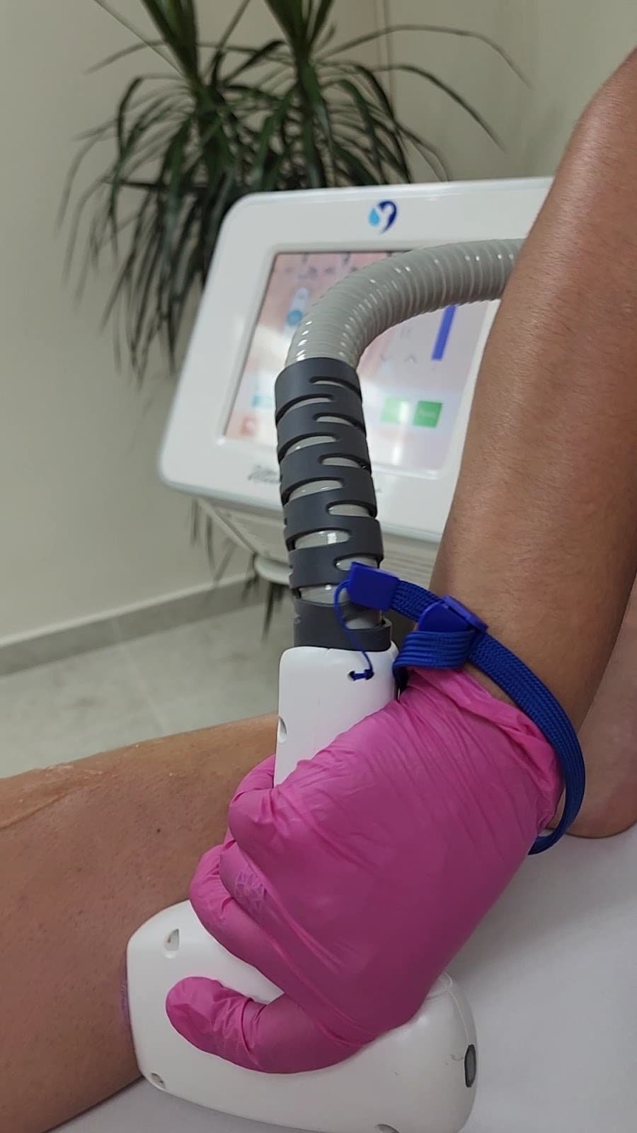 Sesión de depilación láser de piernas con equipo Q4TRO — Bodyfree Panamá